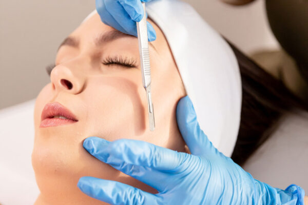 Dermaplaning