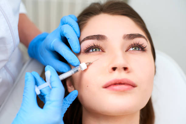 Eye Area